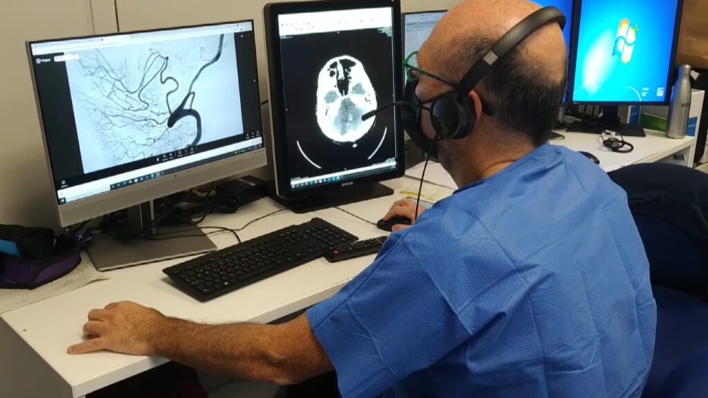 Servei de trombectomia mecànica Hospital Joan XXIII Tarragona